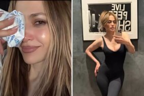 Jennifer Lopez, Amerikan Müzik Ödülleri provaları sırasında yüzünden yaralandı